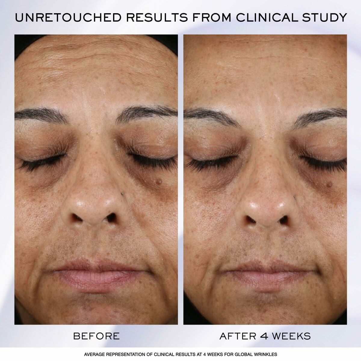 V4HBBDABF4557BD9CED52DFA459CC7FAE5BR5608209P2